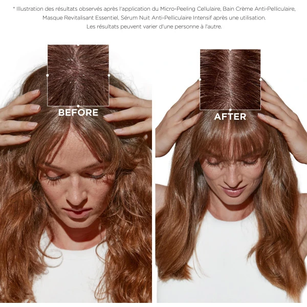 Bain Crème Anti-pelliculaire Symbiose Kérastase 250ML 3 Bain Crème Anti-pelliculaire Symbiose Kérastase 250ML – Image 3