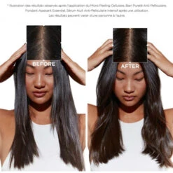 Bain Pureté Anti-pelliculaire Symbiose Kérastase 500ML 9 Bain Pureté Anti-pelliculaire Symbiose Kérastase 500ML -Kérastase bain purete anti pelliculaire symbiose kerastase 500ml 2